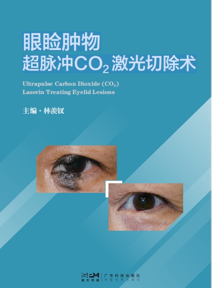 眼睑肿物超脉冲CO2激光切除术