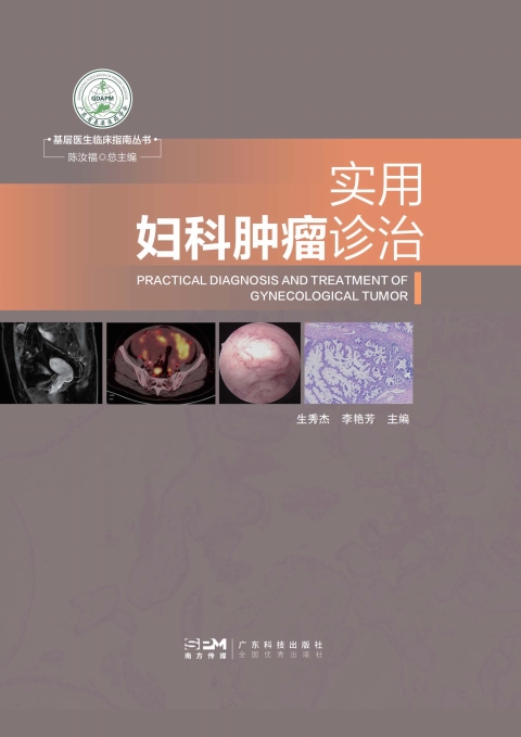 实用妇科肿瘤诊治