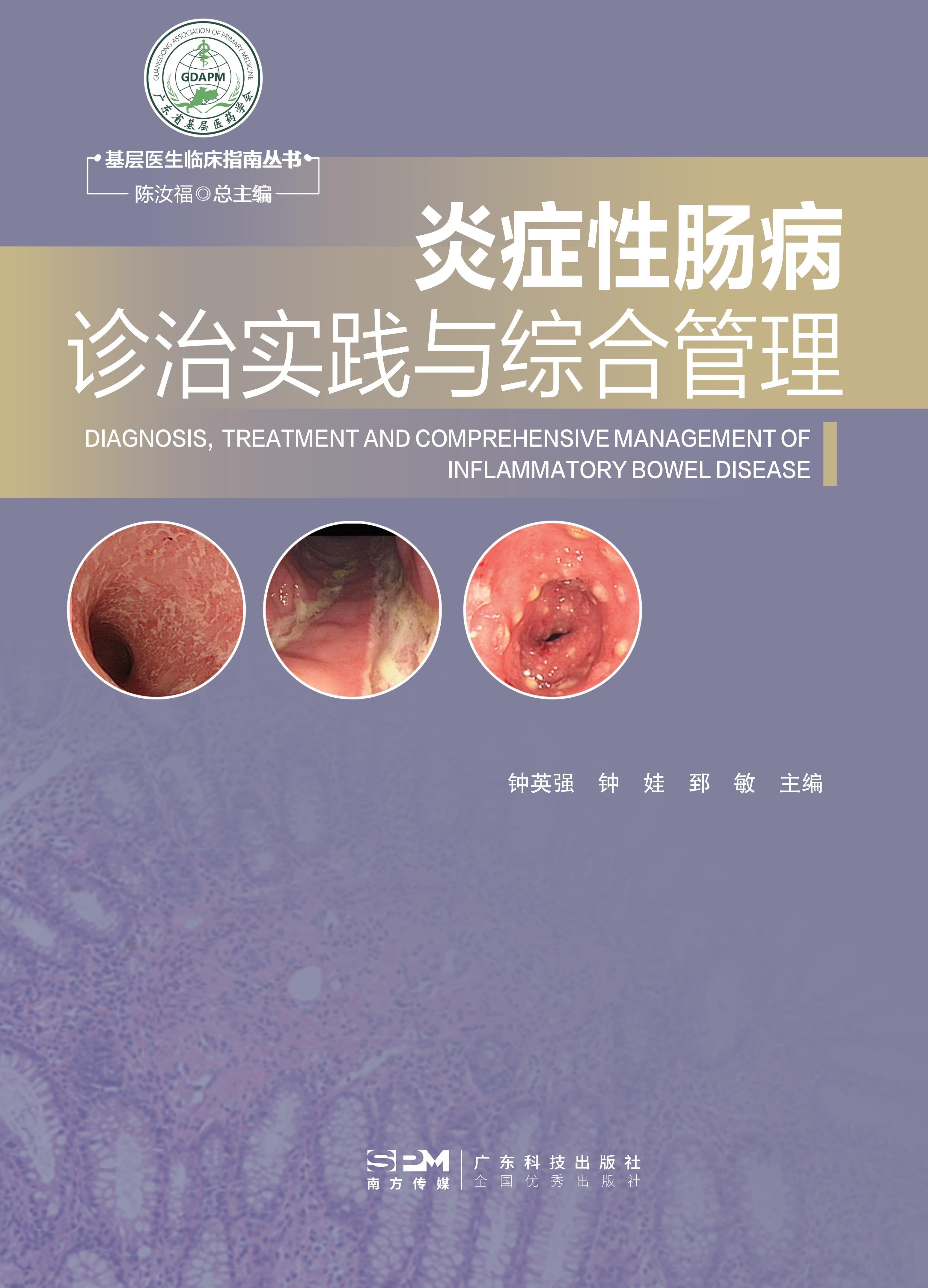 炎症性肠病诊治实践与综合管理