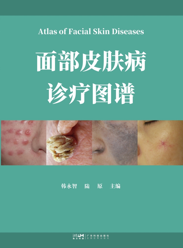面部皮肤病诊疗图谱