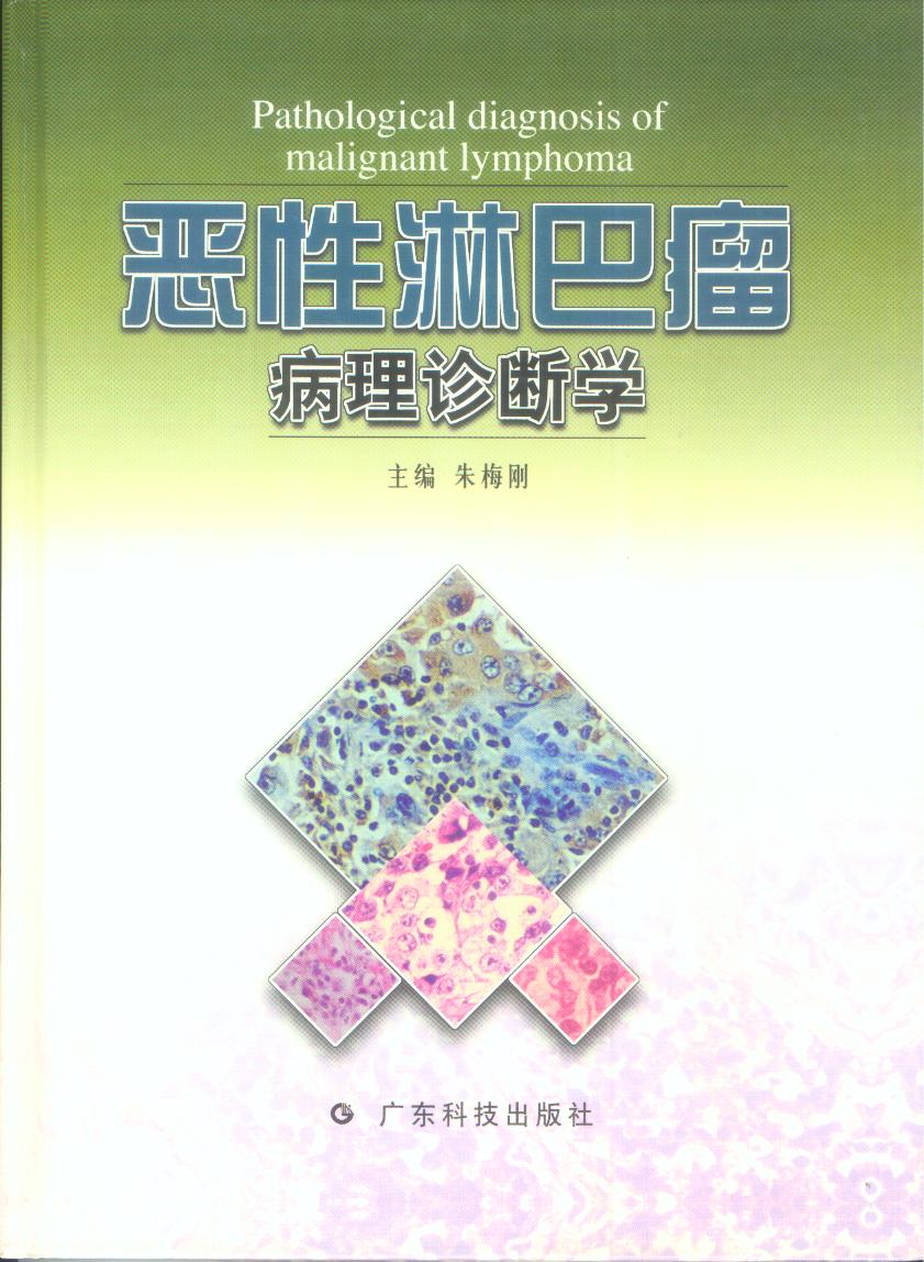 恶性淋巴瘤病理诊断学
