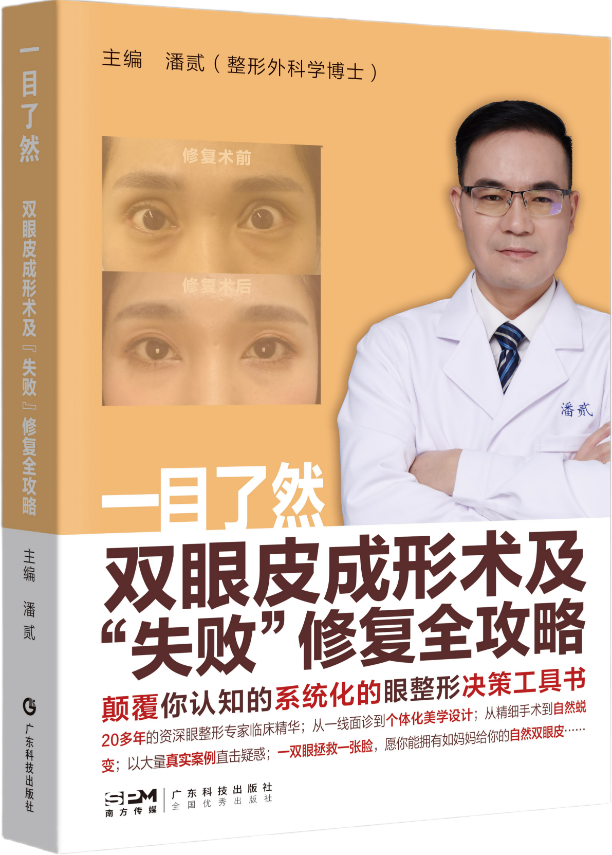 一目了然：双眼皮成形术及“失败”修复攻略