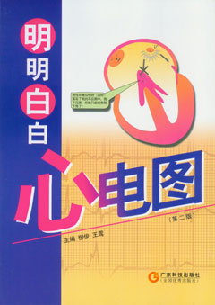 明明白白心电图