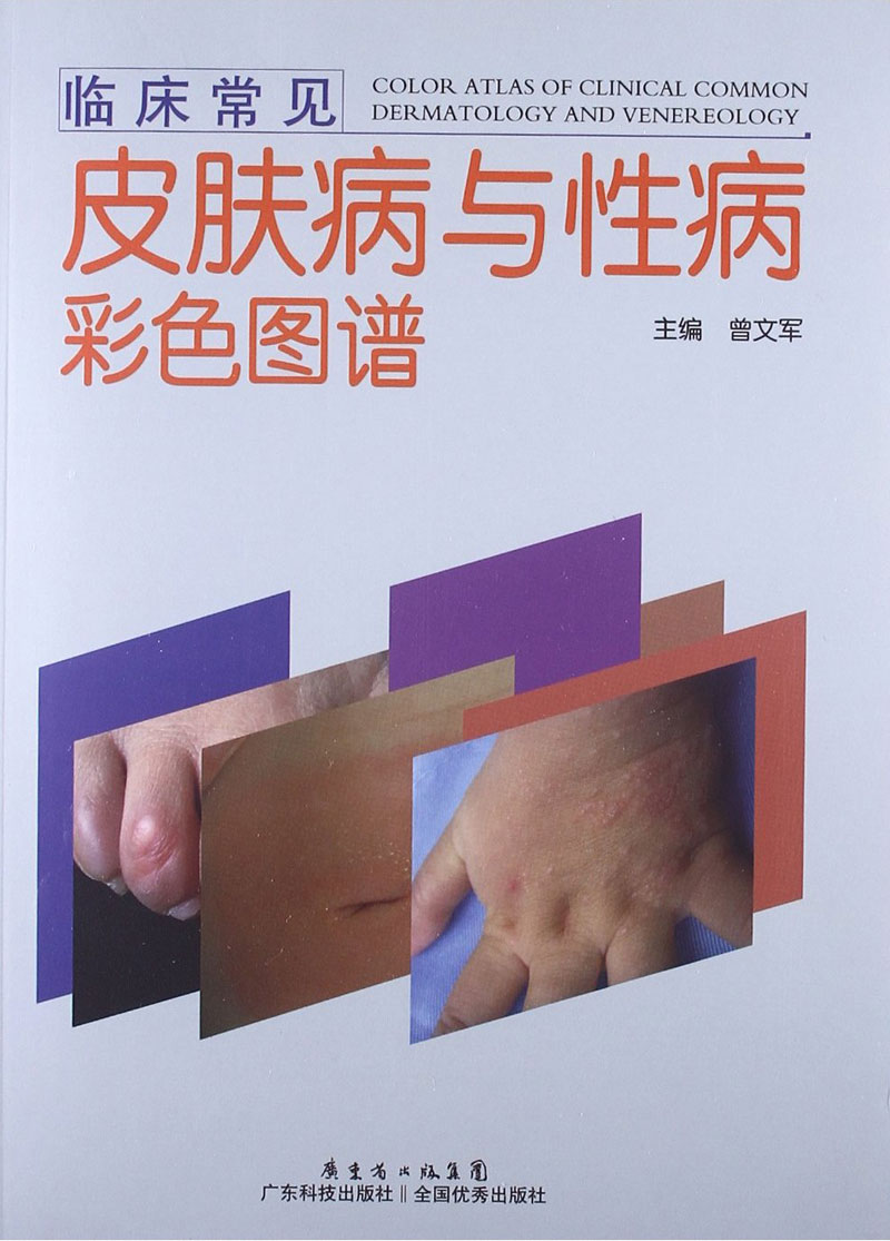 临床常见皮肤病与性病彩色图谱