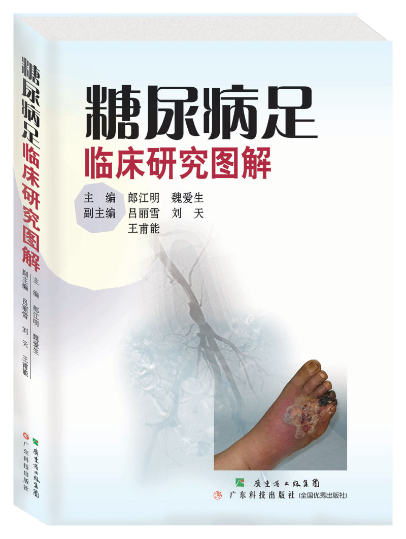 糖尿病足临床研究图解